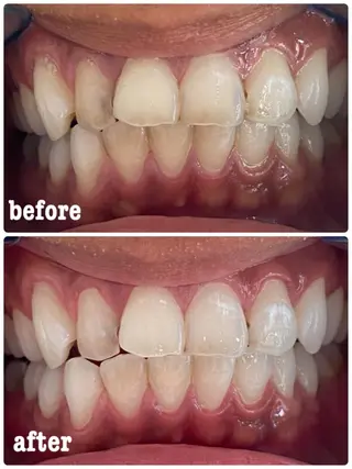 ホワイトニングサロン ラウレアのその他イメージ