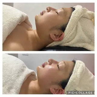 メディカルエステ 痩身·小顔専門サロンBBC 田園調布所属・KEI KOのエステ・リラクイメージ