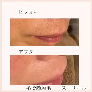 肌荒れに悩む方のため オイルフリーサロンのマツエク・マツパデザイン