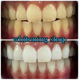 ホワイトニング ショップ吉祥寺店のエステ・リラクイメージ