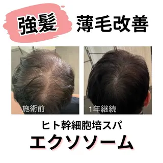 全身もみほぐし もみの樹のエステ・リラクイメージ