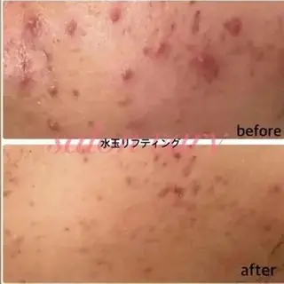 Vary まなみのエステ・リラクイメージ