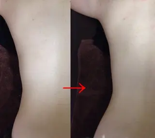 夏までに！ -5kgチャレンジのエステ・リラクイメージ