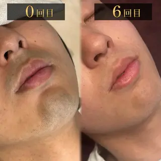 メンズ Grast所属・脱毛＆眉毛サロン メンズ専用Grastの眉毛・アイブロウイメージ