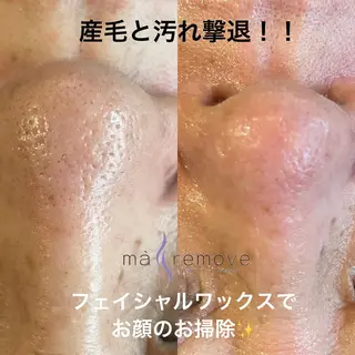 amu nail. RINAのネイルデザイン