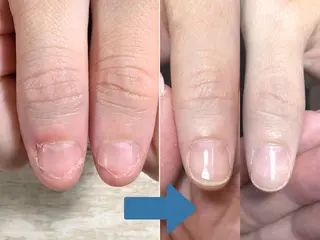 ネイル 深爪矯正・自爪育成 ネイルサロンアモまいのネイルデザイン