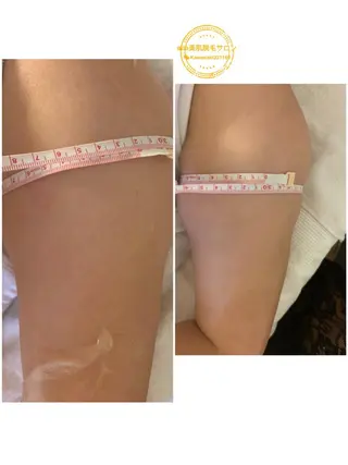 aliaハイフ&水光ジェットサロン所属・aliaハーブ水光店 エステティシャン募集のエステ・リラクイメージ