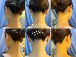 うなじ脱毛/美肌脱毛 LABELのエステ・リラクイメージ