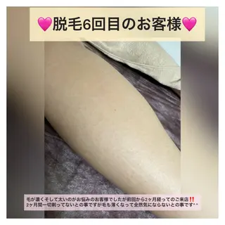 Alphaplus AYAMI のエステ・リラクイメージ