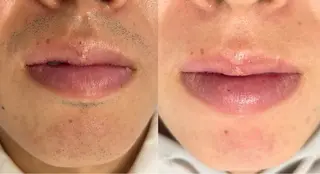 beautysalon FourV所属・名駅🌼無痛美肌脱毛 /フェイシャルのエステ・リラクイメージ