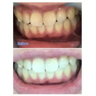 M渋谷店所属・Ｍ渋谷 ホワイトニングのエステ・リラクイメージ