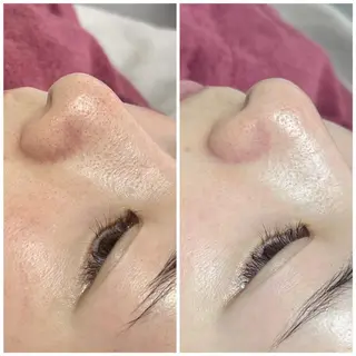 部分痩せ♥️小顔専門 MIKUのエステ・リラクイメージ