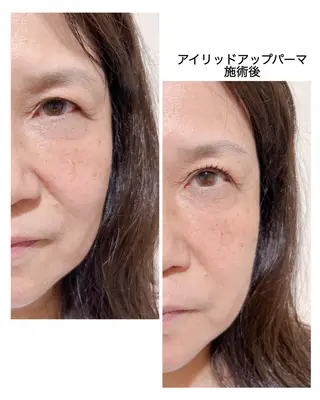 マツエク・マツパ merveilles所属・まつげ/整体/にきび ・アトピー専門サロンのマツエク・マツパデザイン