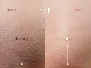 MOMO BEAUTY所属・Momo beautyのその他イメージ