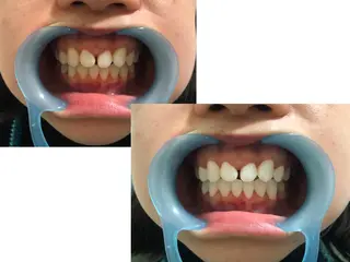 ミディアム カラー キッズ パーマ ネイル ヘアアレンジ マツエク・マツパ メンズ アイブロウ 中目黒 ホワイトニングサロンのその他イメージ