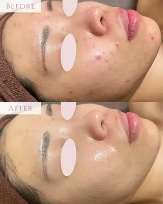 肌質改善サロン LesFleursのエステ・リラクイメージ