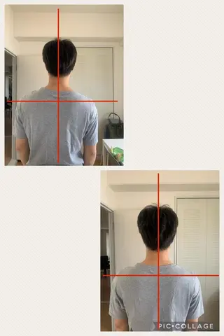 治療しない治療院(KiND整体院)所属・食事制限・運動なし 根本改善ダイエットのエステ・リラクイメージ