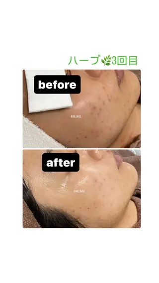 スカルプ💅🏻 /ホワイトニングのネイルデザイン