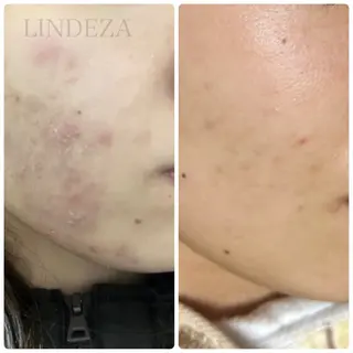 private salon 𝐋𝐈𝐍𝐃𝐄𝐙𝐀所属・LINDEZA Ayaのエステ・リラクイメージ