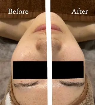 脱毛サロン fam.豊澤柚良のエステ・リラクイメージ