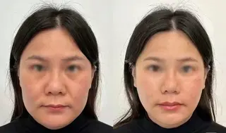 ネイル aliaハイフ&水光ジェットサロン所属・aliaハーブ水光店 エステティシャン募集のエステ・リラクイメージ