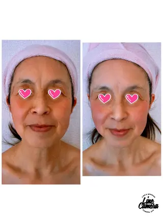 Lupine （エステティシャン）のエステ・リラクイメージ