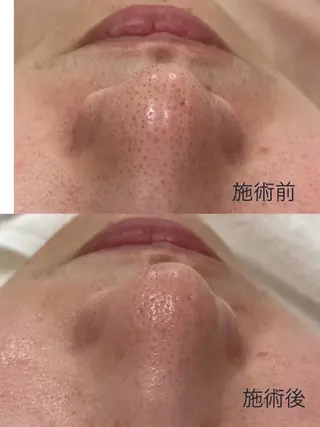 六本木脱毛andS さおりのエステ・リラクイメージ