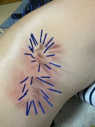 さや 鍼灸院のその他イメージ