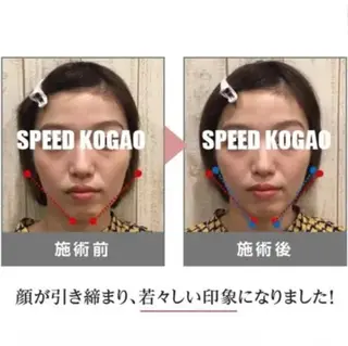 小顔矯正 natsuのエステ・リラクイメージ