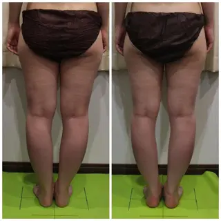 ANRIRE (アンリール)のエステ・リラクイメージ