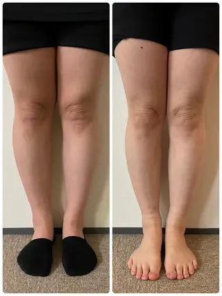 Fuu（ふぅ）所属・肩こり・首コリ 専門店Fuüのエステ・リラクイメージ