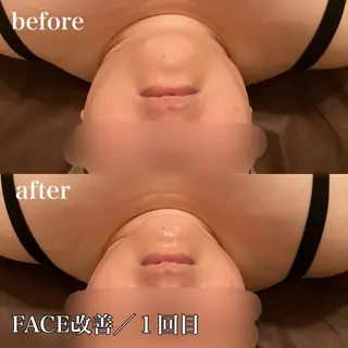 磐田｜LAYLA 一番丁寧な脱毛店のエステ・リラクイメージ