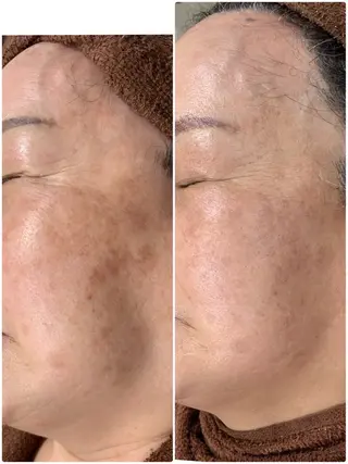 プライベート脱毛 Jr久宝寺のエステ・リラクイメージ