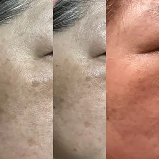 Relaxation SalonARONAのエステ・リラクイメージ