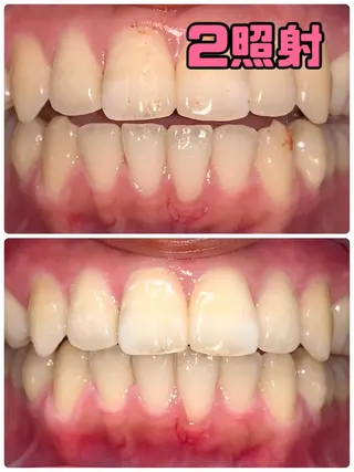 LOVE ホワイトニング渋谷のその他イメージ