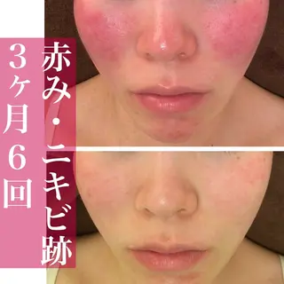 ニキビ・肌質改善専門 ♡人生が変わるサロンのエステ・リラクイメージ