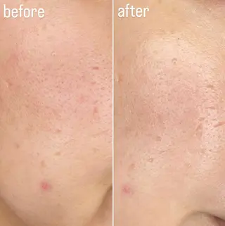 Re Amply Minamiのエステ・リラクイメージ