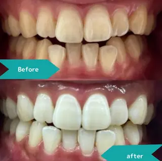 凛 リンのネイルデザイン