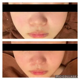 セミロング カラー パーマ ヘアアレンジ メンズ キッズ ネイル マツエク・マツパ アイブロウ ニキビ特化型エステ 🍓最短で肌質改善のエステ・リラクイメージ