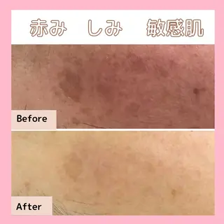 エステサロン　Sブランペタル所属・三沢市エステサロン Sブランペタルのエステ・リラクイメージ