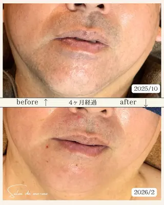 吉沢 晴のエステ・リラクイメージ