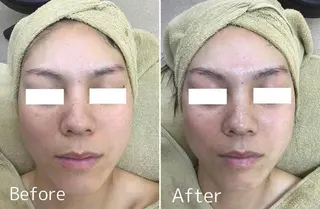 鈴木 直子のエステ・リラクイメージ