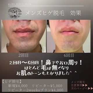 メンズ マツエク・マツパ Lino 《リノ》のエステ・リラクイメージ