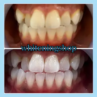 ホワイトニング ショップ千葉店のその他イメージ