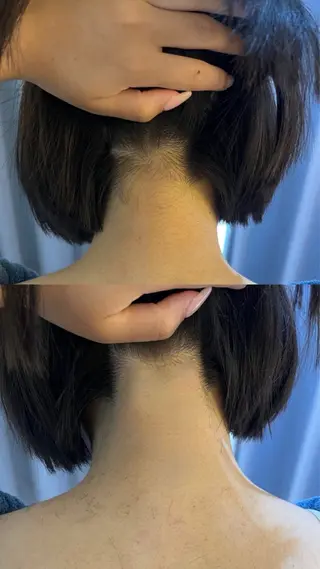 うなじ脱毛/美肌脱毛 LABELのエステ・リラクイメージ