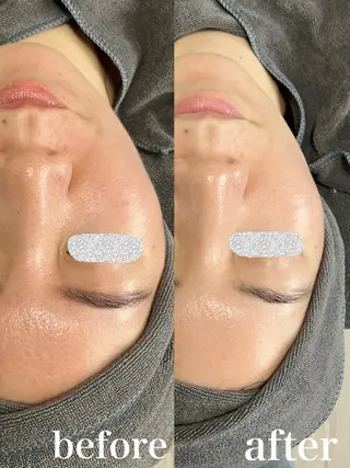 a.spa＆herb所属・a.spa&herb 船橋北口店のエステ・リラクイメージ