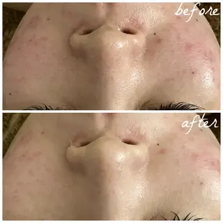 メンズ メナード岐阜茜部 杉浦のエステ・リラクイメージ