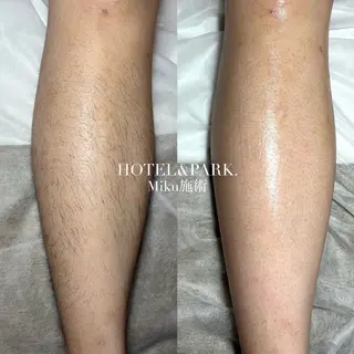 HOTEL&PARK Mikuワックス脱毛のエステ・リラクイメージ