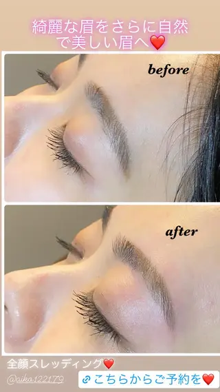 アイブロウ ハーブピーリング/韓国肌管理/フェイシャル/毛穴洗浄/眉毛/顔脱毛【糸脱毛専門】rev所属・ハーブピーリング🌹 毛穴洗浄❤️眉waxのエステ・リラクイメージ