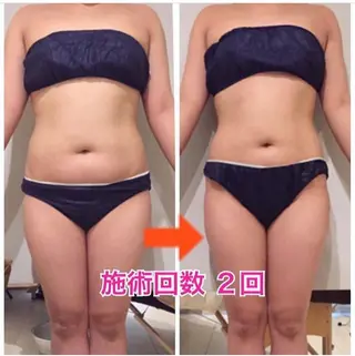 カラー パーマ ヘアアレンジ メンズ キッズ ネイル マツエク・マツパ ‍痩身＆ボディ 結果出し🌟丹野のエステ・リラクイメージ